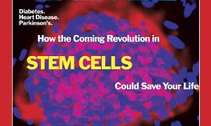Time heart valve disease stem cell treatment options  301x180 Stem Cell Therapy for Heart Disease  Coronary Artery Disease CAD & PAD