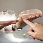 silicone vs saline breast implants thailand 150x150 Breast Implants Thailand   Breast Implants Bangkok