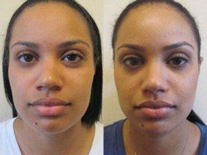 Multi-Cultural and Ethnic Cosmetic Surgeries